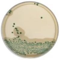 Brilliance_Listeria_Agar_Plates_gotowa_pożywka_do_oznaczania_Listeria_Bestlabs.jpg