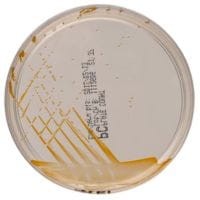 Plate Count Agar gotowa pożywka na płytce