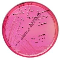 XLD_Medium_Agar_gotowa_pożywka_do_identyfikacji_Salmonella_Shigella_spp_Bestlabs.jpg