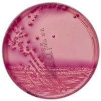 MacConkey_No.3_gotowa_pożywka_do_wykrywania_E. coli_Bestlabs.jpg