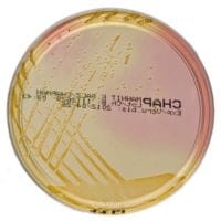 Mannitol Salt Agar gotowa pożywka do oznaczania gronkowców