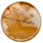 Brilliance_UTI_Clarity_Agar_pożywka_gotowa_Argenta.jpg