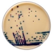 Brilliance VRE Agar gotowa pożywka do oznaczania Enterococcus opornych na wankomycynę (VRE)