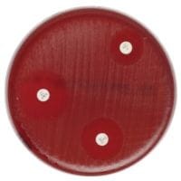 Mueller_Hinton_Agar_with_Sheep_Blood_gotowa_pożywka_na_płytkach_Bestlabs.jpg