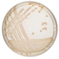 Nutrient_Agar_gotowa_pożywka_na_płytkach_Petriego_Bestlabs.jpg