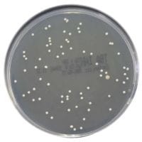 Tryptone Soya Agar + disinhibitor gotowa pożywka na płytkach Petriego
