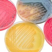 MRS Agar modified with Chalk gotowa pożywka na płytkach