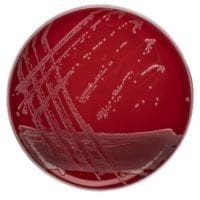 Columbia_CNA_STAPH/STREP_gotowa_pożywka_na_płytkach_Petriego_Bestlabs.jpg