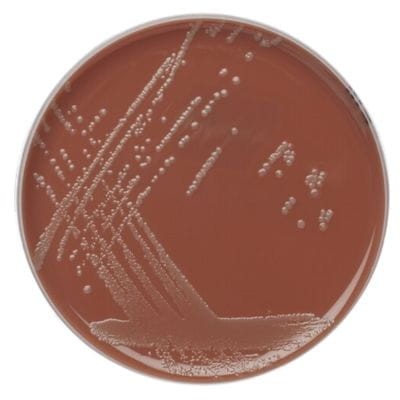 Chocolate Agar with Vitox gotowa pożywka na płytkach