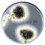 Sabouraud_Glucose_Selective_Agar_gotowa_pożywka_na_płytkach_do_izolacji_dermatofitów_innych_grzybów_drożdży_Bestlabs.jpg