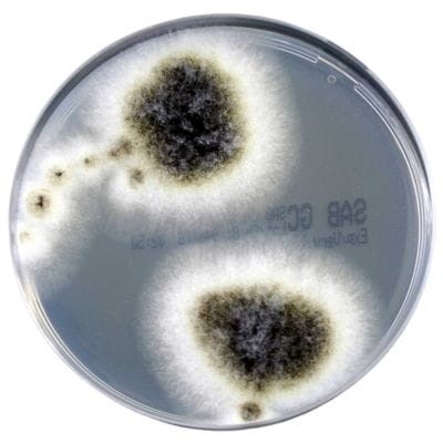 Sabouraud Glucose Selective Agar gotowa pożywka na płytkach do izolacji dermatofitów innych grzybów i drożdży