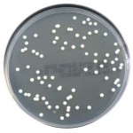 Sabouraud_Glucose_Selective_Agar_gotowa_pożywka_na_płytkach_do_izolacji_dermatofitów_innych_grzybów_drożdży_Bestlabs.jpg
