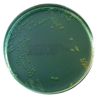 Hektoen_Enteric_Agar_gotowa_pożywka_na_płytkach_Bestlabs.jpg
