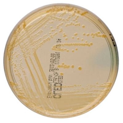 CLED Medium gotowa pożywka na płytkach do wykrywania powszechnych patogenów dróg moczowych