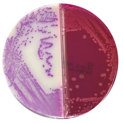 Brilliance_Salmonella_XLD_Agar_gotowa_pożywka_na_dzielonych_płytkach_Bestlabs.jpg