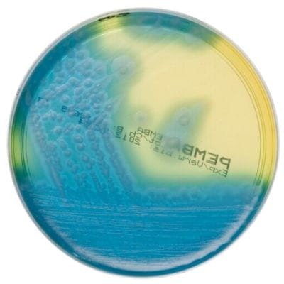 Bacillus_cereus_Selective_Agar_gotowa_pożywka_na_płytkach_Bestlabs.jpg