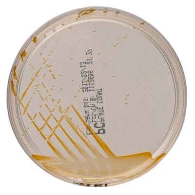 Plate Count Agar gotowa pożywka na płytkach