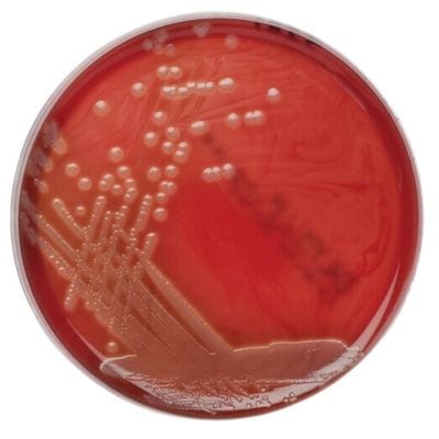 Enterohamolysin Agar z krwią gotowa pożywka na płytkach do izolowania enterohemolizyny enterokrwotocznej Escherichia coli (EHEC)