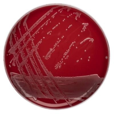 Columbia Agar with Sheep Blood gotowa pożywka na płytkach