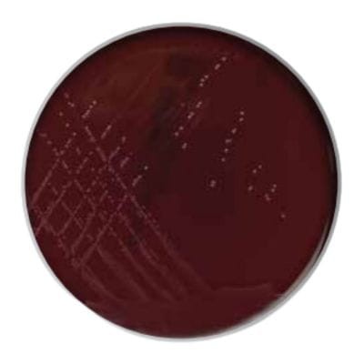 Edwards_Medium_with_Sheep_Blood_Modified_gotowa_pożywka_na_płytkach_Bestlabs.jpg