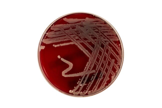 Staphylococcus-aureus-ATCC 25923-on-Tryptone-Soya-Prepared-Agar-Plate-with-Sheep-Blood-PB5012A.jpg-650.jpg
