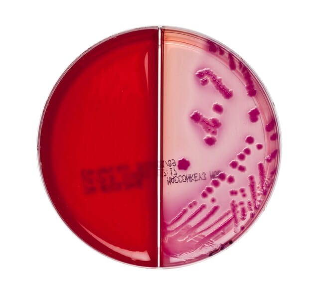 Escherichia-coli-ATCC 25922-on-Columbia-CNA Aesculin-Selective-Agar-and-Macconkey-No3-mod-Agar-Split-Plate-low-res.jpg-650.jpg