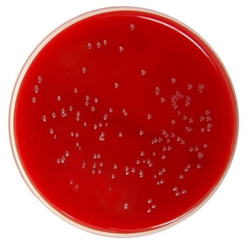 Mueller Hinton Agar with Horse Blood + NAD gotowa pożywka na płytkach