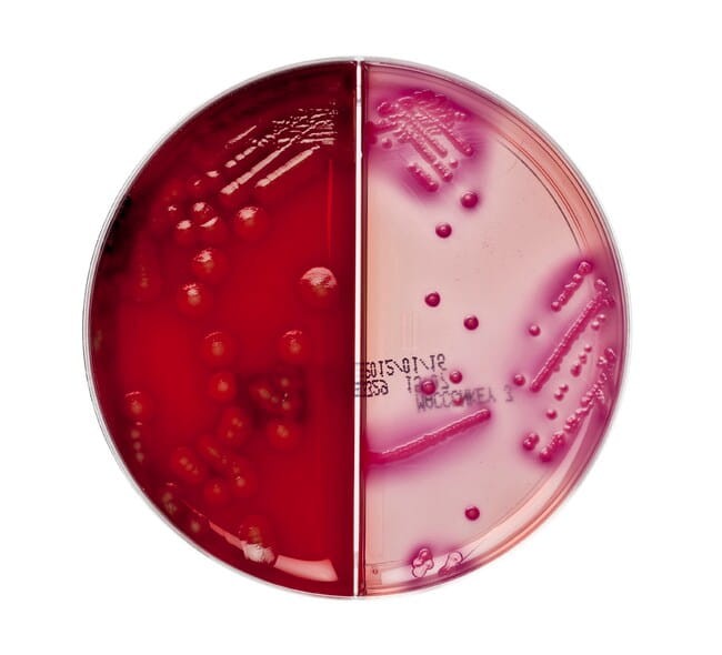 Escherichia-coli-ATCC 25922-on-Columbia-Agar-with-Blood-and-Macconkey-Agar-Split-Plate-low-res.jpg-650.jpg