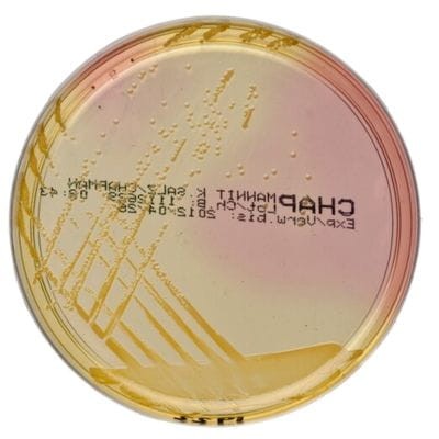 Mannitol_Salt_Agar_Bestlabs.jpg