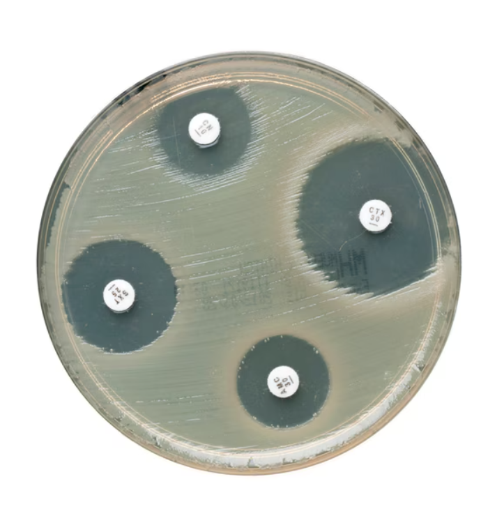 Escherichia-coli-ATCC 35218-on-Mueller-Hinton-Agar-Plate-argenta