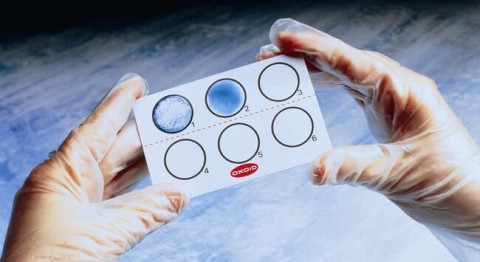 Staphytect Plus Test aglutynacji lateksowej