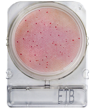 Compact Dry ETB - gotowe płytki do oznaczania Enterobacteriaceae w kontroli higieny produkcji kosmetyków