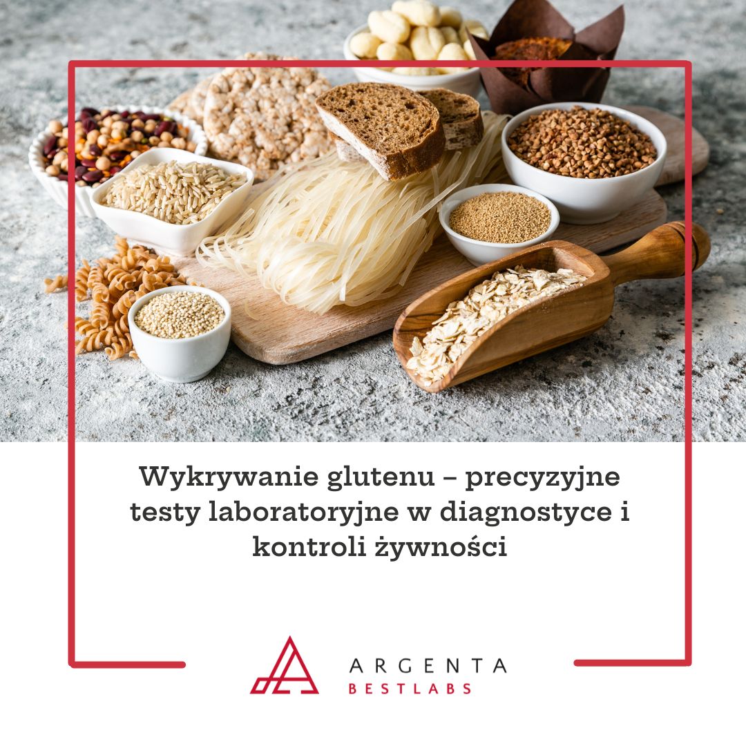 Wykrywanie glutenu – precyzyjne testy laboratoryjne w diagnostyce i kontroli żywności