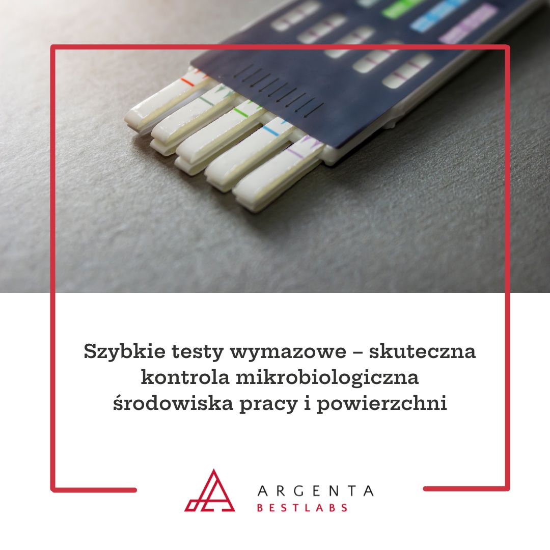 Szybkie testy wymazowe – skuteczna kontrola mikrobiologiczna środowiska pracy i powierzchni