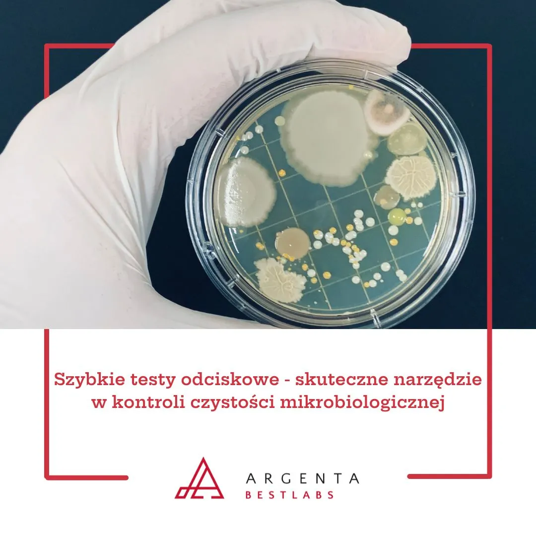 Szybkie testy odciskowe - skuteczne narzędzie w kontroli czystości mikrobiologicznej