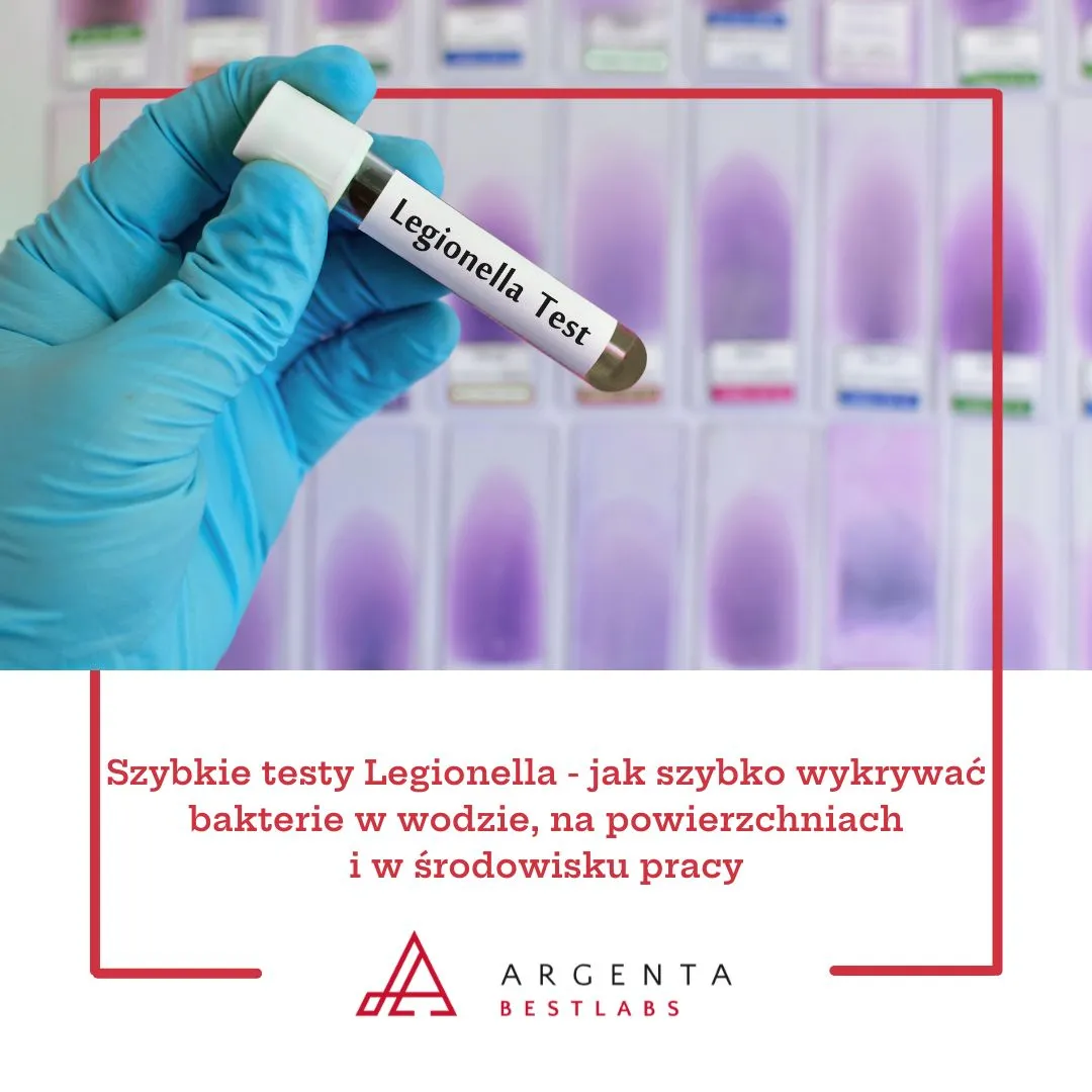 Szybkie testy Legionella - jak szybko wykrywać bakterie w wodzie, na powierzchniach i w środowisku pracy