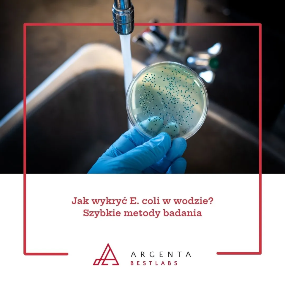 Jak wykryć E. coli w wodzie – szybkie metody badania